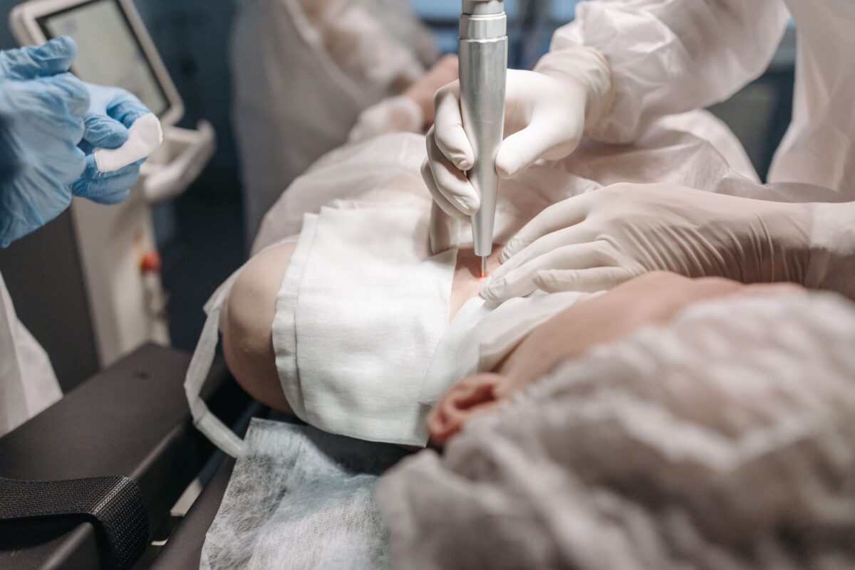 épilation laser attendre ressemble évolution plusieurs